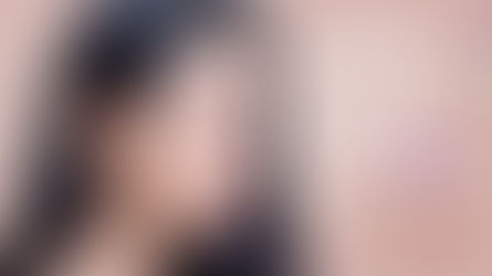 รีวิวเสริมจมูกแบบธรรมชาติ โรงพยาบาลวิว View Plastic Surgery