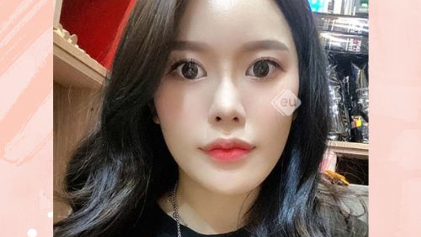 รีวิว ศัลยกรรมแก้คางเบี้ยว โรงพยาบาลอียู (ตอนที่ 1)