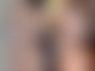 จมูกโด่งแล้ว แต่อยากให้เป็นทรงที่สวย ก็สามารถทำได้น้าาา