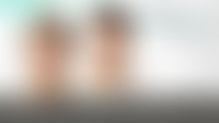 การศัลยกรรมวิธี All for one คืออะไร