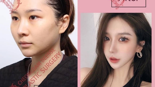 โครงหน้าสวยละมุน ฉายาเจ้าหญิงแห่งวงการโครงหน้า (ตอนที่ 2)