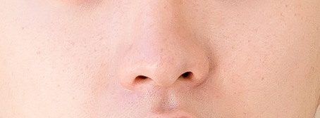 ศัลยกรรมจมูกผู้ชาย มีความซับซ้อน