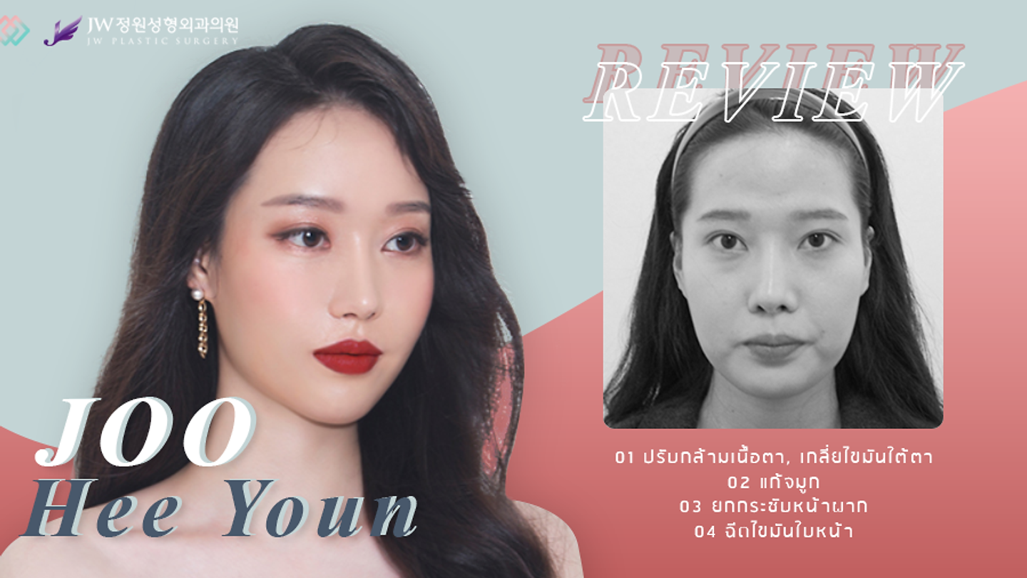 รีวิวยกกระชับหน้าผาก ฉีดไขมัน (ตอนที่ 1)