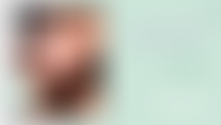 ศัลยกรรมจมูก และดูดไขมันหน้า คุณคิม ฮานา