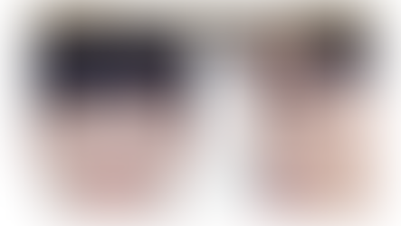 (รีวิวศัลยกรรม) ส่องรัวๆ !!! รีวิว เสริมจมูกผู้ชาย สไตล์โอปป้า กับ 5 โรงพยาบาลศัลยกรรมเกาหลี ยอดฮิต