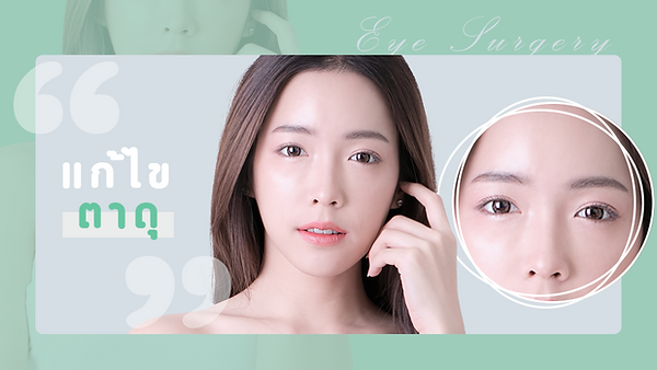 ดวงตาดุ สามารถแก้ไขปัญหาได้อย่างไร (ตอนที่ 1)