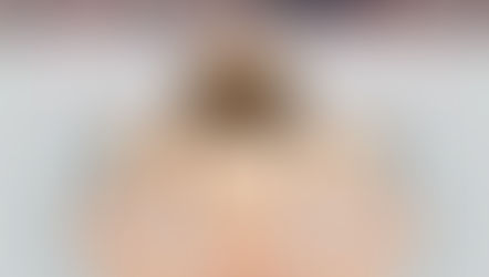 ศัลยกรรมเกาหลีแพลนบุกตลาดต่างประเทศ ในปี 2019