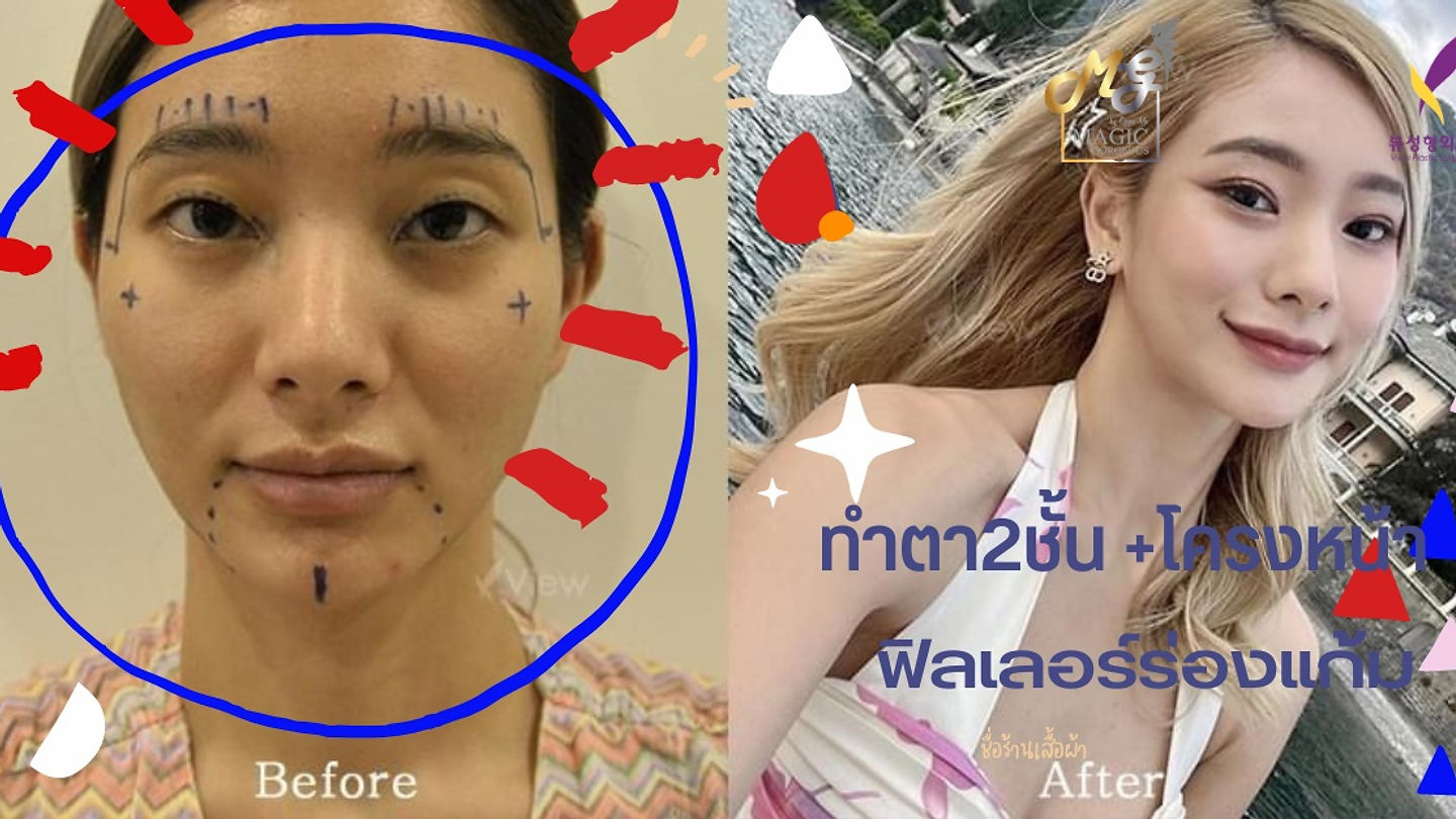 ทำไมต้องเป็น…….View Plastic Surgery (ตอนที่ 1)