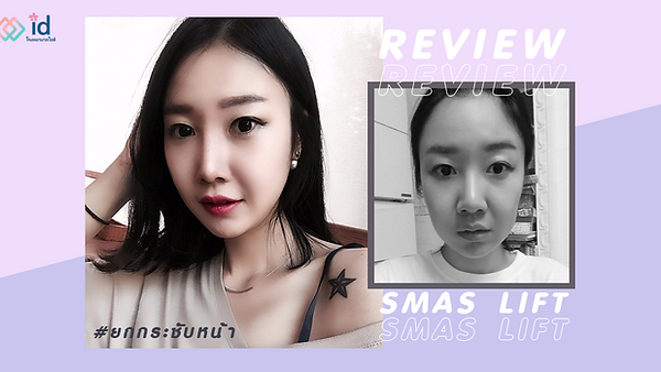 ยกกระชับผิวหน้า แบบไม่กรีด แก้ปัญหาผิวหย่อนคล้อย (ตอนที่ 1)