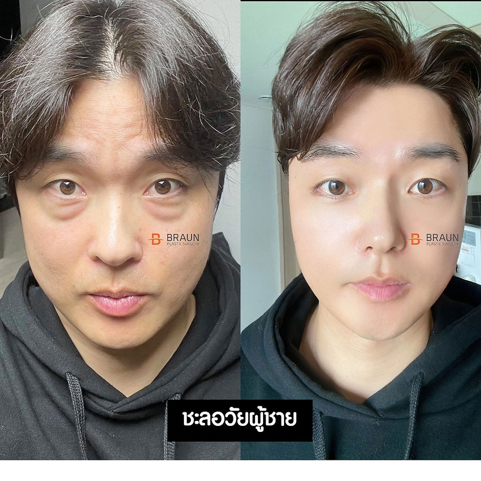 รีวิวศัลยกรรมผู้ชาย > โรงพยาบาลบราวน์ (Braun Plastic Surgery)
