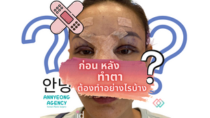 ก่อน-หลังทำตา ต้องทำอะไรบ้าง ?