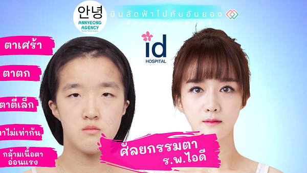 รวมรีวิวศัลยกรรมตา ร.พ.ไอดี (ตอนที่ 1)