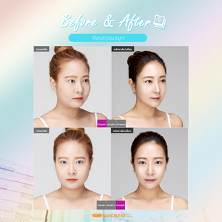โรงพยาบาลบาโนบากิ (Banobagi Plastic Surgery)