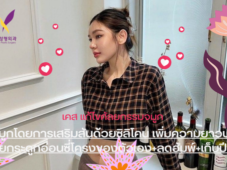 งานแก้ไหนๆก็ไม่เลิศ…….เท่างานนี้😍