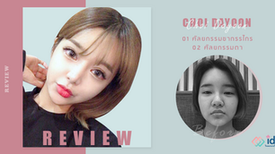 รีวิวผ่าตัดขากรรไกร ไม่ต้องจัดฟัน และทำตาสองชั้น วิธีกรีด