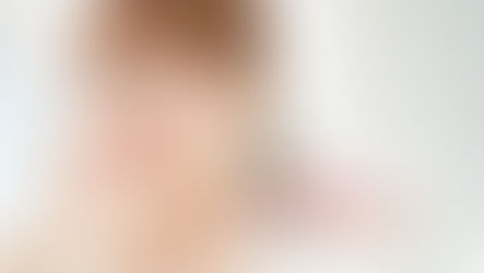 โบท็อกซ์ ธรรมชาติที่ไม่โอ้อวด