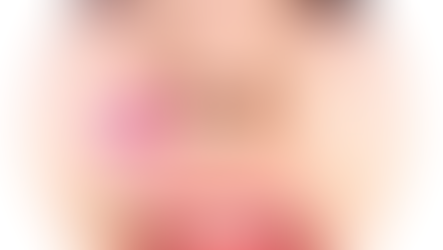 เสริมร่องแก้มด้วยซิลิโคน