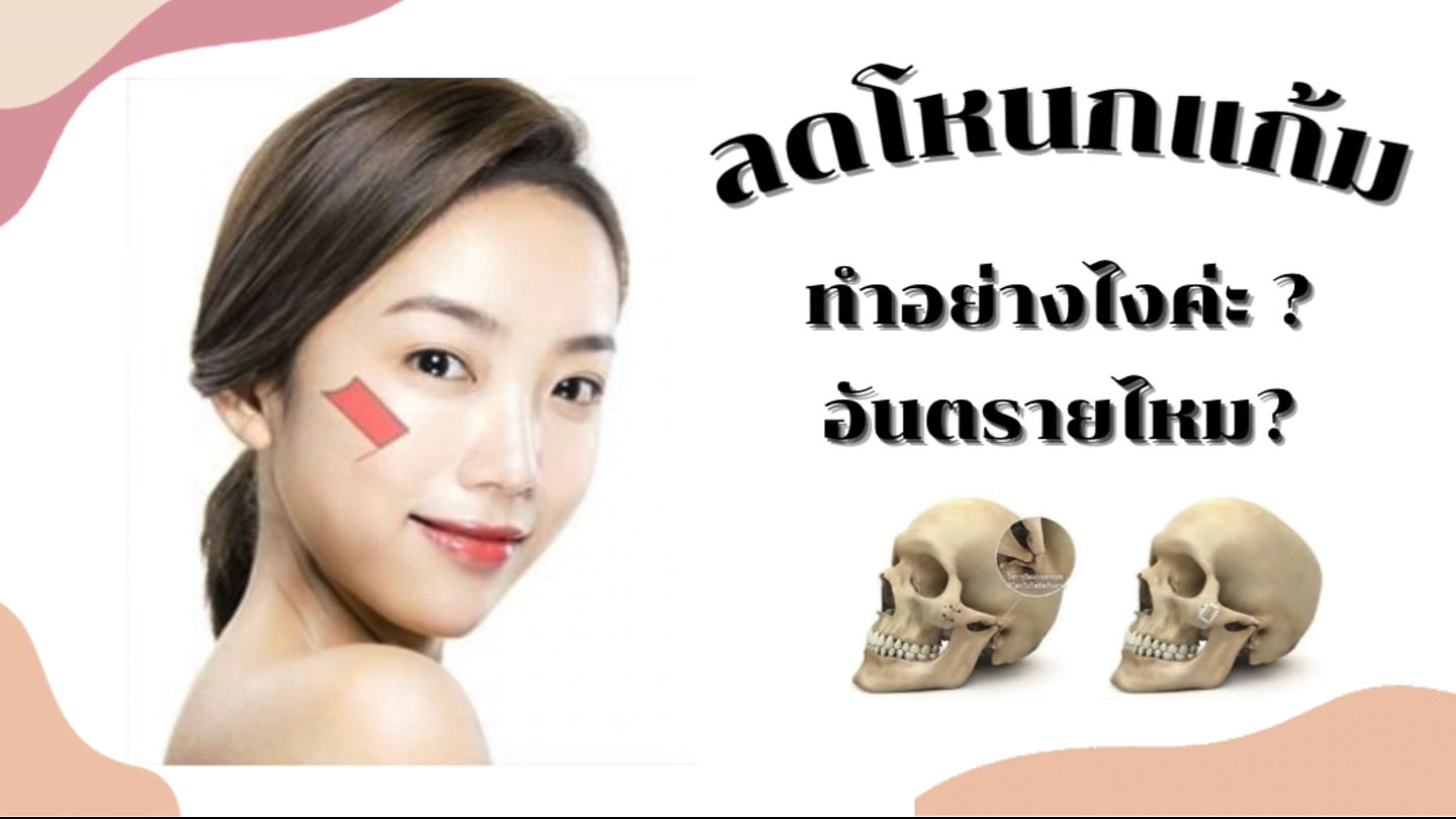 “ลดขนาดโหนกแก้ม” ทำอย่างไร? อันตรายไหม?