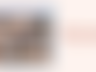 รีวิวศัลยกรรมจมูก