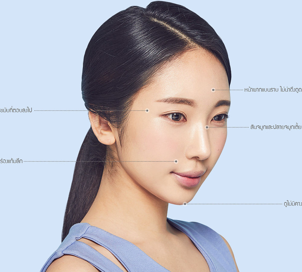 หน้าผากแบนราบ ไม่น่าดึงดูด - ขมับที่ตอบลงไป - สันจมูกและปลายจมูกเตี้ย - ร่องแก้มลึก - ดูไม่มีคาง