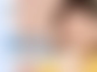 ศัลยกรรมลดโครงหน้า ปรับกระดูกกรอบหน้าและกรอบหน้าแบบ V-line