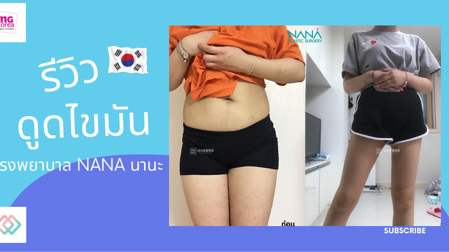 รีวิวดูดไขมัน โรงพยาบาล NANA นานะ (ตอนที่ 1)