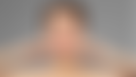 อาคิวลิฟท์ติ้ง คืออะไร?