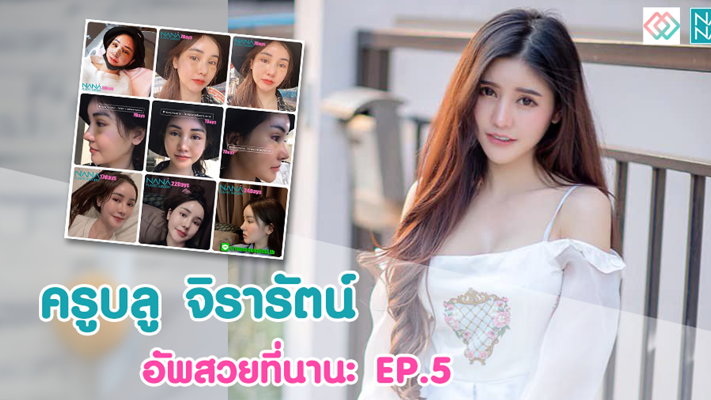 บลูจิรารัตน์ บินลัดฟ้าไปทำจมูกกับตา ปรับโครงหน้า ที ร.พ.นานะ