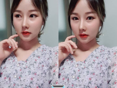 รีวิวศัลยกรรมแก้จมูกแบบ Full Option ที่โรงพยาบาลมาอิน