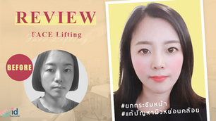 รีวิวยกกระชับใบหน้า ลดอายุ สวยแบบ Baby Face