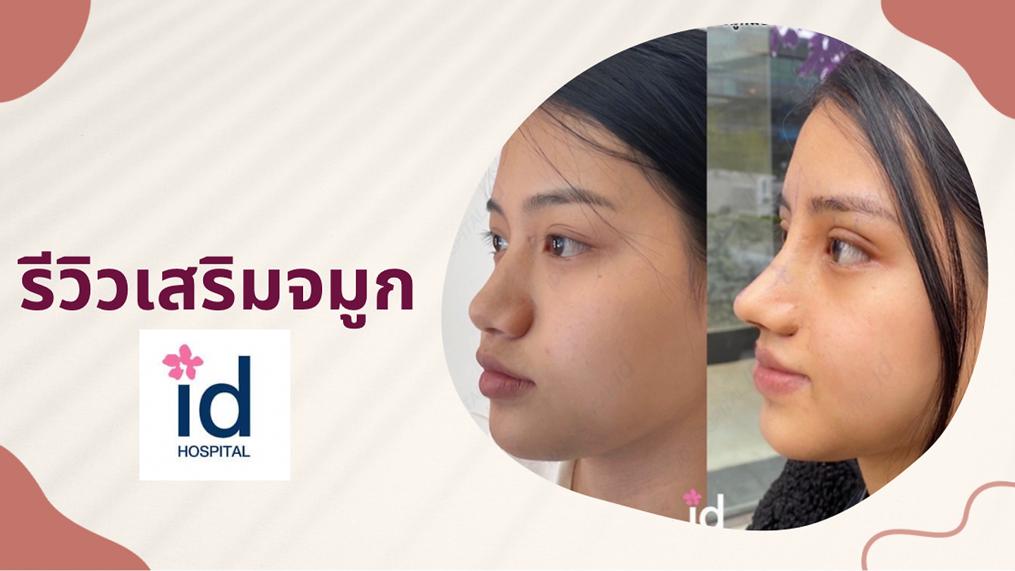 รีวิวศัลยกรรมจากลูกค้าจริง (ตอนที่ 3)