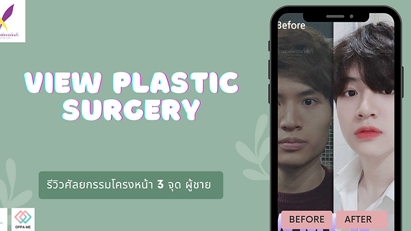 รีวิวศัลยกรรมโครงหน้า 3 จุด ผู้ชาย (ตอนที่ 1)