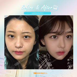 โรงพยาบาลบาโนบากิ (Banobagi Plastic Surgery)