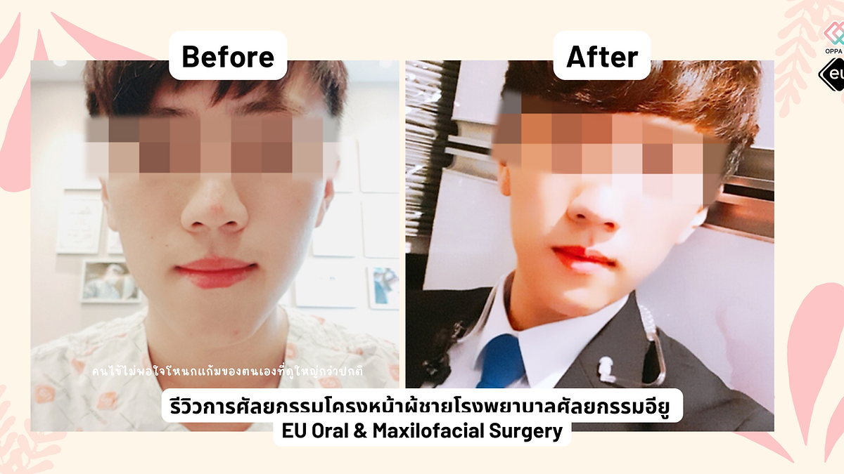 Cover image for the Korean plastic surgery hospitals section