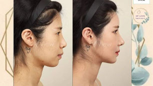 📍Real Review โรงพยาบาลศัลยกรรมวิว📍