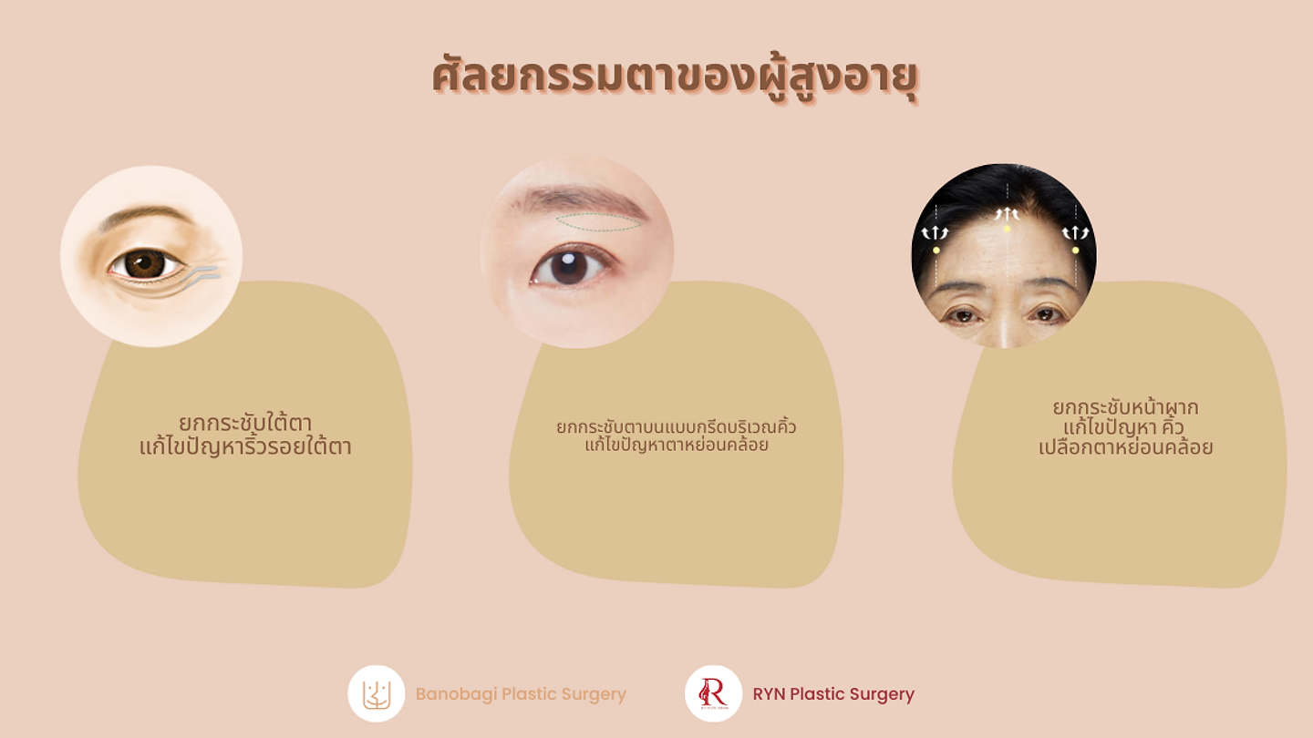 ศัลยกรรมตาสำหรับผู้สูงอายุ เพื่อดวงตาที่อ่อนเยาว์และใบหน้าที่สดใส
