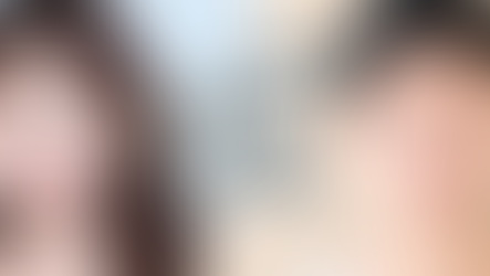 ศัลยกรรมจมูกผู้ชาย แตกต่างจากผู้หญิง