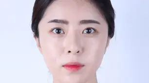 รีวิวปรับโครงหน้า กำจัดไขมันใต้ตา และดูดไขมัน (เหนียง)