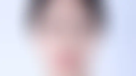 รีวิวปรับโครงหน้า กำจัดไขมันใต้ตา และดูดไขมัน (เหนียง)