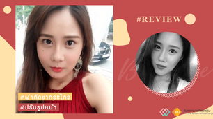 รีวิวศัลยกรรมแก้โครงหน้า และผ่าตัดขากรรไกร