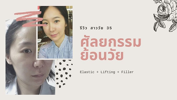 รีวิว ศัลยกรรม Elastic , เติมไขมัน, ยกกระชับหน้า, Filler (ตอนที่ 1)