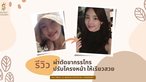 รีวิวปรับโครงหน้า+ขากรรไกรให้เรียวสวย (ตอนที่ 1)