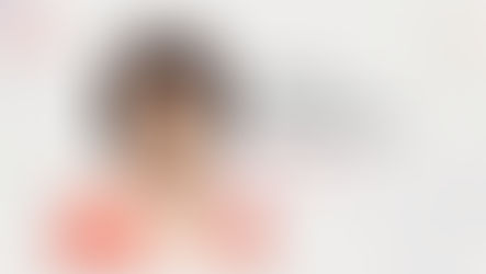 ศัลยกรรมยกกระชับตาบนแบบกรีดบริเวณคิ้ว ผลลัพธ์ที่ดีและดูเป็นธรรมชาติ