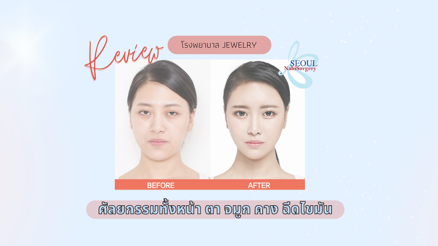 Before-After ศัลยกรรมทั้งหน้า ตา จมูก คาง ฉีดไขมันจบครบที่โรงพยาบาล Jewelry (ตอนที่ 2)
