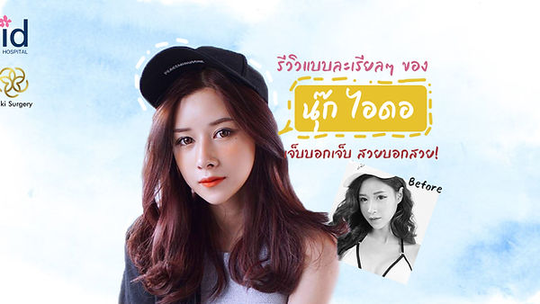 รีวิวศัลยกรรมโครงหน้า ฉบับละเอียดของ “นุ๊ก ไอดอ” ที่เรียลกว่านี้ไม่มีอีกเล้ว เจ็บบอกเจ็บ สวยบอกสวย (ตอนที่ 1)