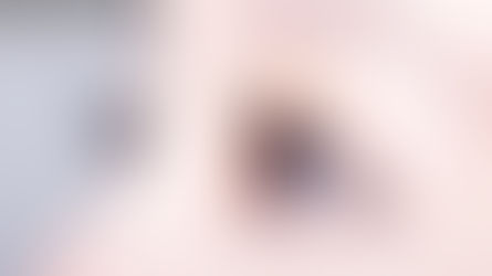 ทำตาสองชั้น vs ปรับกล้ามเนื้อตา แตกต่างกันอย่างไร?