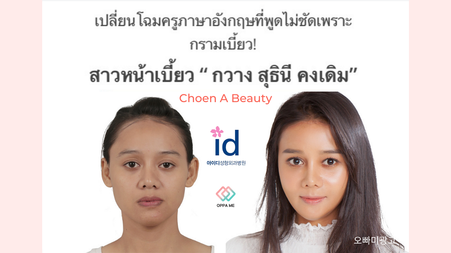 เปลี่ยนโฉมครูสอนภาษาอังกฤษที่พูดไม่ชัดเพราะกรามเบี้ยว โดยรพ.ไอดี (ตอนที่ 1)