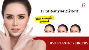 หัวเถิก หน้าผากกว้าง แก้ไขได้ด้วย “ศัลยกรรมลดขนาดหน้าผาก”