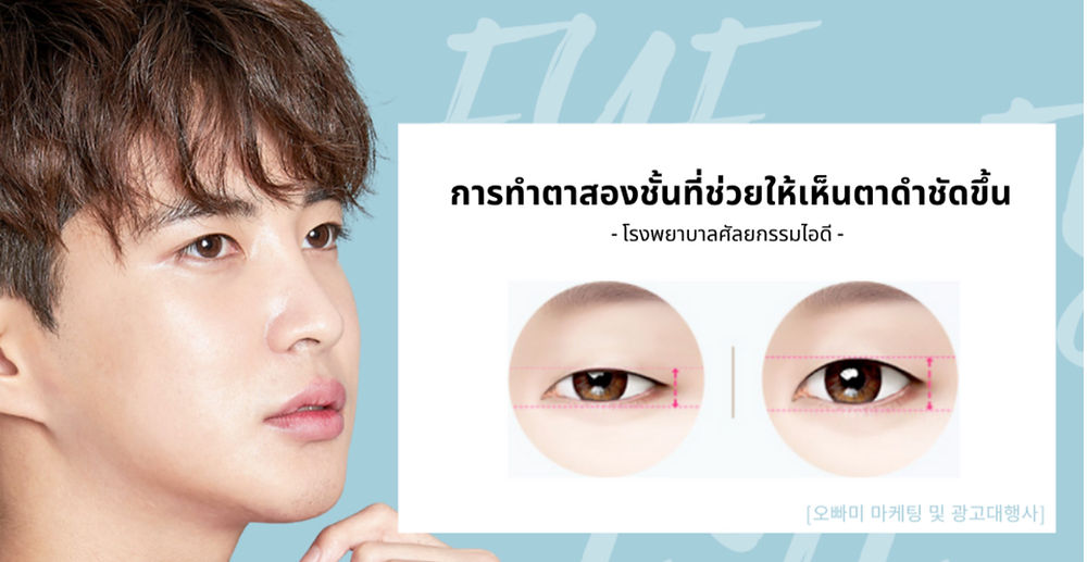 รีวิวศัลยกรรมผู้ชาย เกาหลี