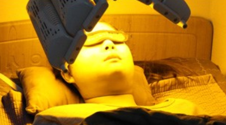 ผิวแก้มหย่อนคล้อย หลังลดโหนกแก้ม